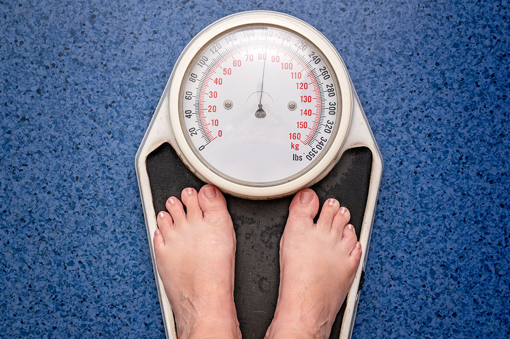 Best health insurance plans for weight loss surgery