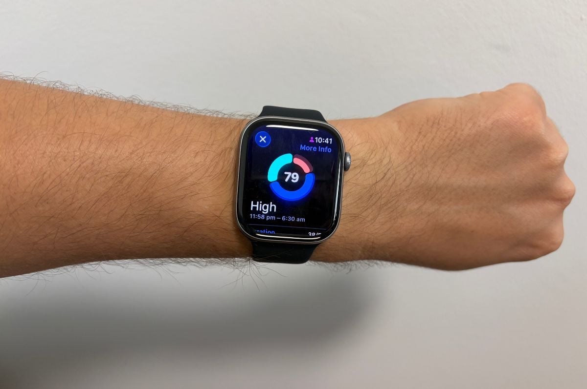 Apple Watch Series 11 Apple Watch Series 11